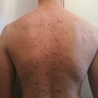 Person enjoying a hands-free back scrub in the shower